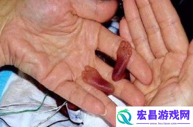 “史上最小BB”争夺战