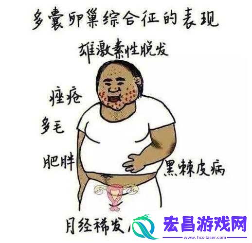综合一与综合二图片区别是什么