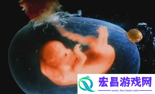 胎儿露头