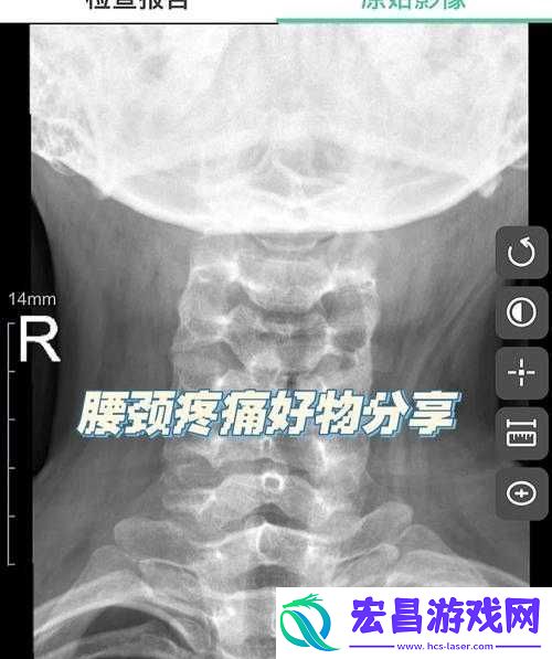 颈腰挺过那层薄膜好疼