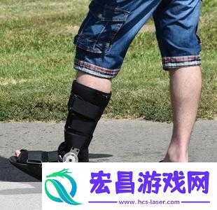 夫君摔断腿后