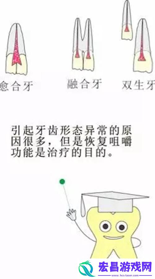 13岁PG