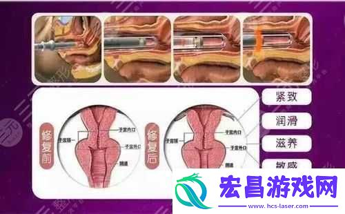 欧洲之星私密紧致