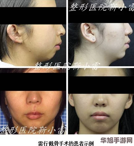 红桃视颏隐藏