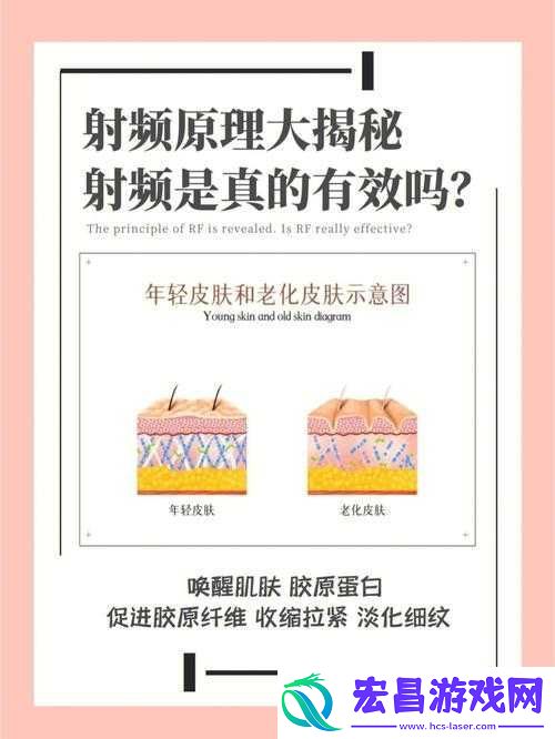 RF射频的原理和作用