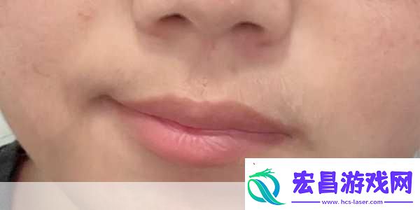 16岁唇毛明显到18岁还会长吗