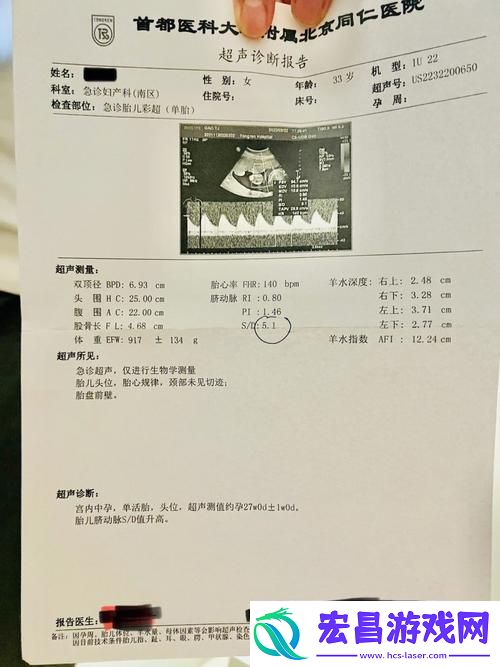 “OVO食肉族报告4”