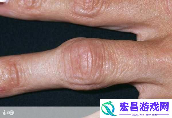宝宝怎么才三根手指就痛1.宝宝为何三根手指就感到疼痛