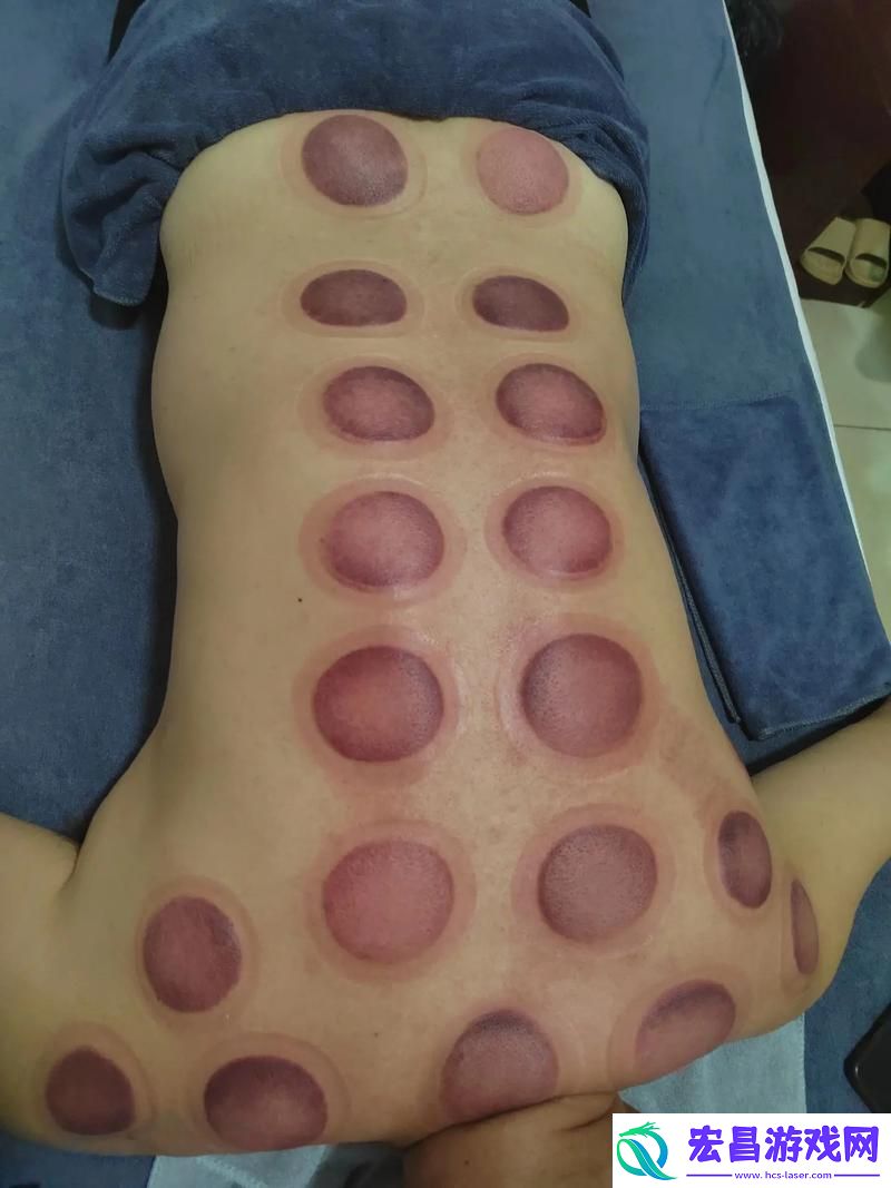 排毒大爷的奥秘