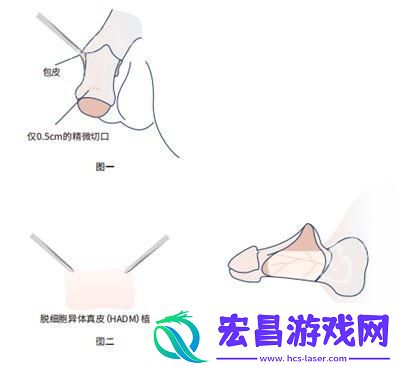 “粗”中有细