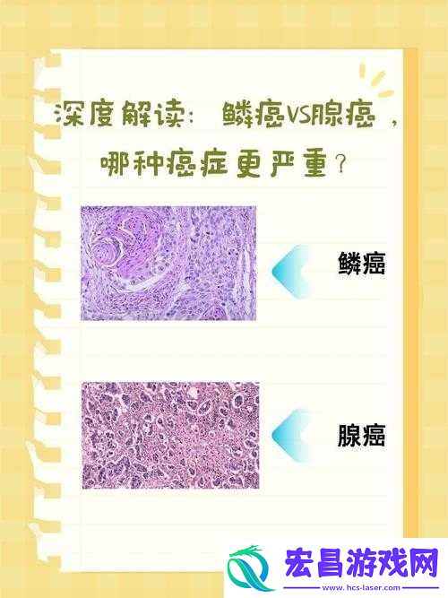 松紧和水哪个更重要