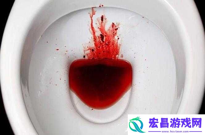 尿在肚子里不能流出来肉的严重后果