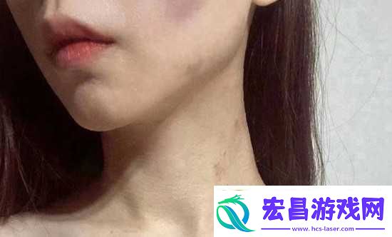 红雅典娜LIYA死了吗
