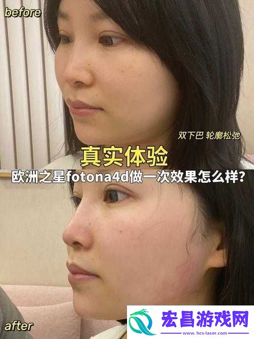 欧洲之星