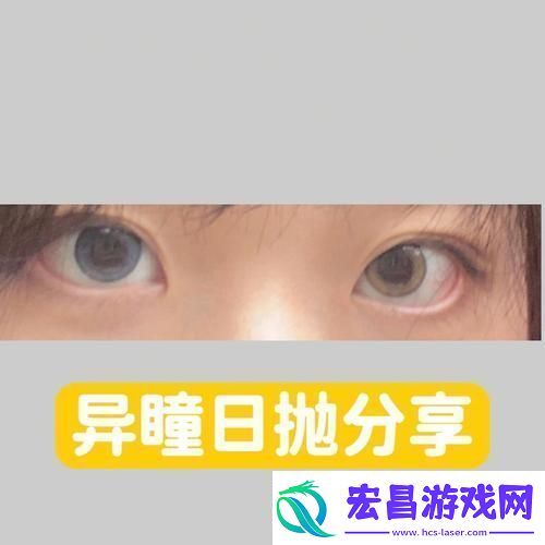 后天如何拥有异色瞳