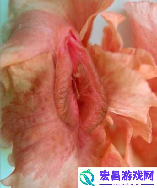女人下边又肥又大又黑该如何应对呢