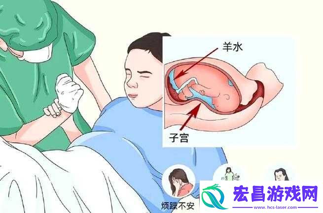 羊水栓塞