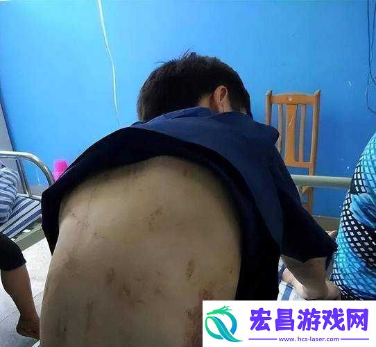 喑缅北恐怖站www缅甸
