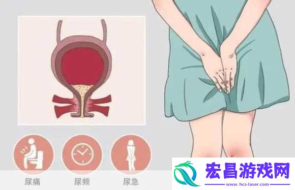 WRITEAS憋着尿按压肚子“憋尿困难如何巧妙应对”