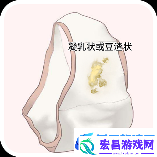 女生次数多了会有豆腐渣分泌物吗