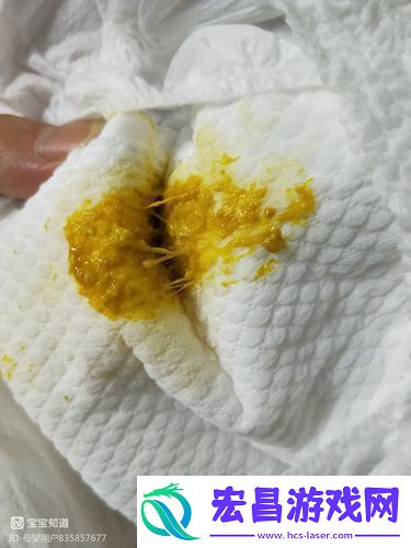 水拉丝了小东西喷出来了怎么办