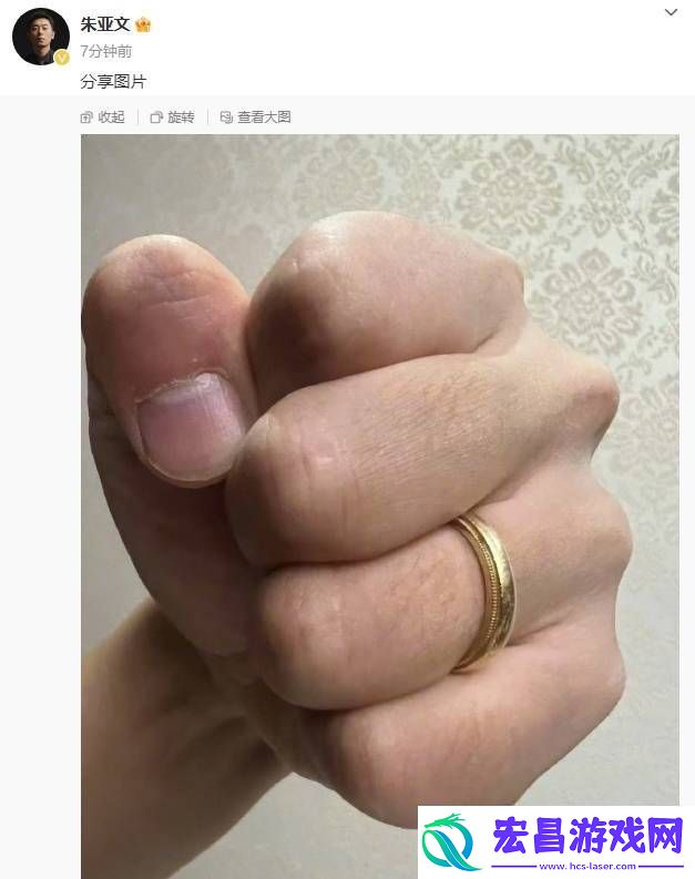 朱亚文晒手戴婚戒照片