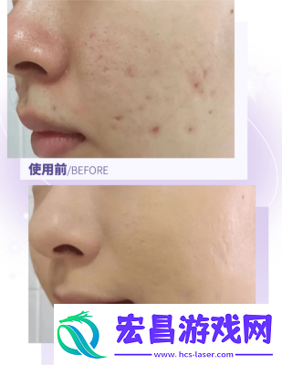 精油一线二线三线区别在哪