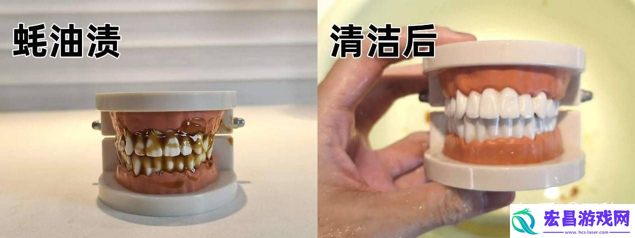 2025年口腔护理新宠！知乎大咖力荐欧可林AirPumpA10氧气啵啵冲牙器