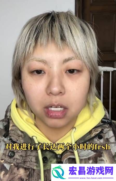 张大大疑似殴打工作人员
