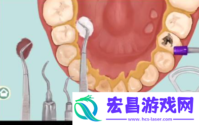 小小收纳唇红齿白怎么过关