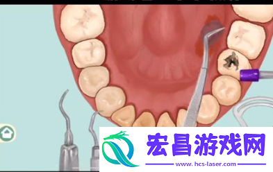 小小收纳唇红齿白怎么过关