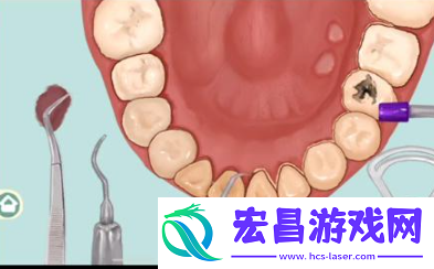 小小收纳唇红齿白怎么过关