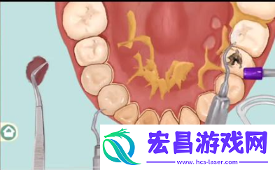 小小收纳唇红齿白怎么过关