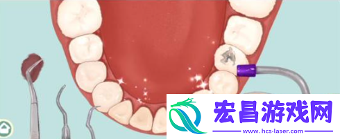 小小收纳唇红齿白怎么过关