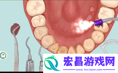 小小收纳唇红齿白怎么过关