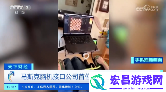医保报销“脑机植入手术”-夜之城就在身边