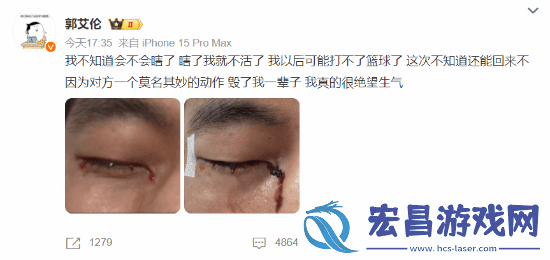 对抗拉满