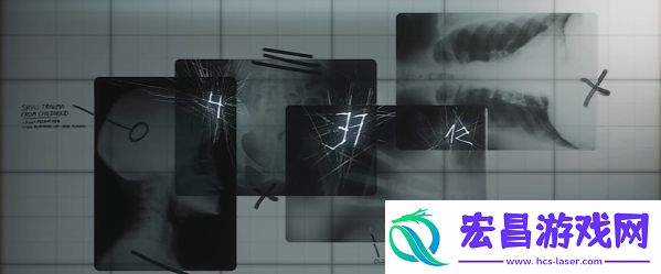 寂静岭2重制版医院三楼转盘锁怎么开
