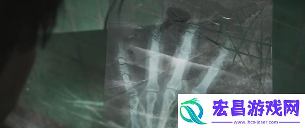 寂静岭2重制版医院三楼转盘锁怎么开