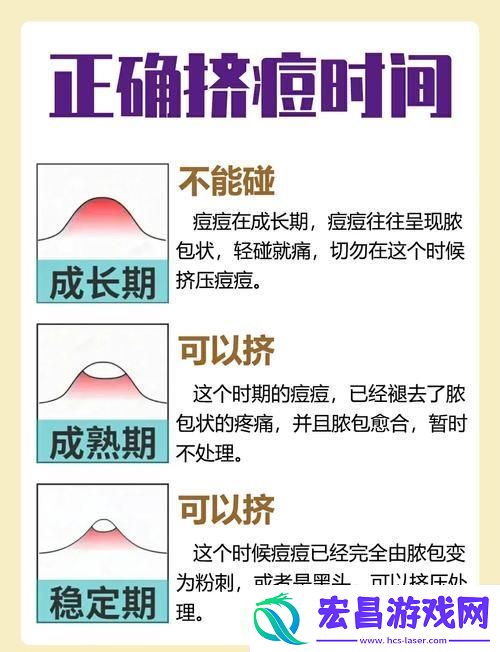 怎样弄小痘痘才会浑身酥软上线